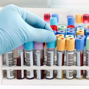 „Vacutainer“ kraujo vamzdeliai